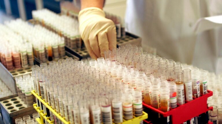 EU-Gesundheitsbehörde: Sexuell übertragbare Krankheiten breiten sich in Europa schneller aus