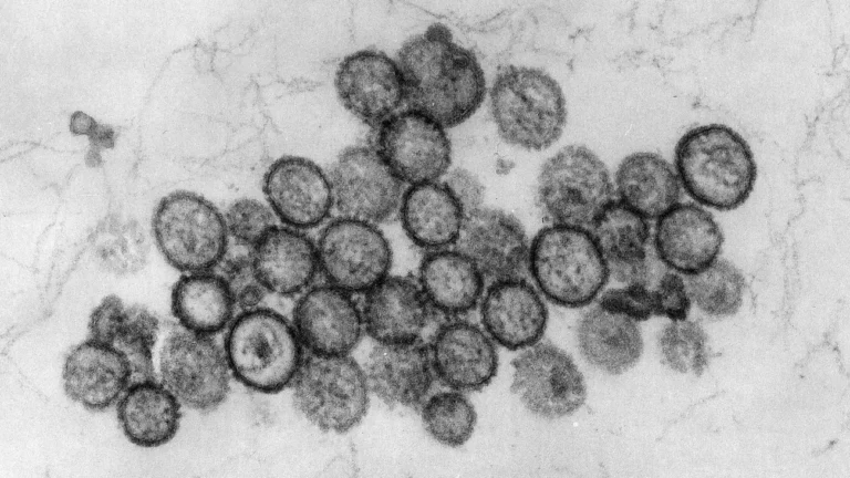 Atemwegserkrankung: Hantavirus: Drei Tote auf Kreuzfahrtschiff im Atlantik