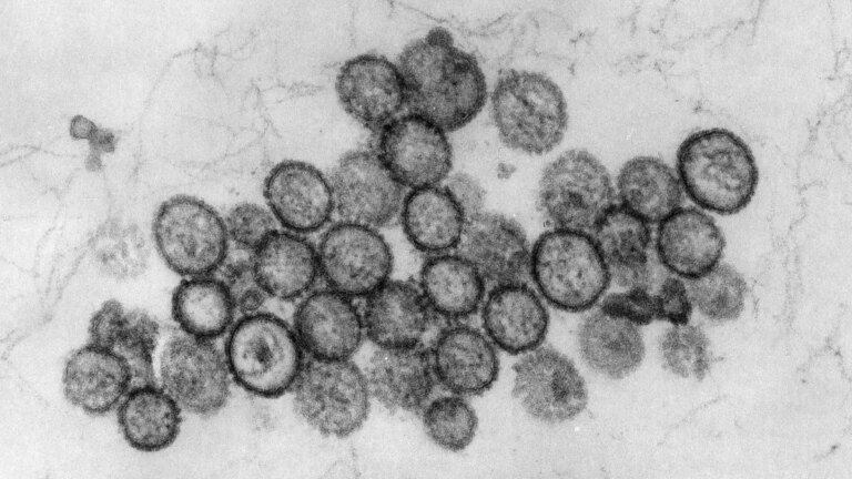 Hantavirus-Ausbruch auf Kreuzfahrtschiff – Wissen