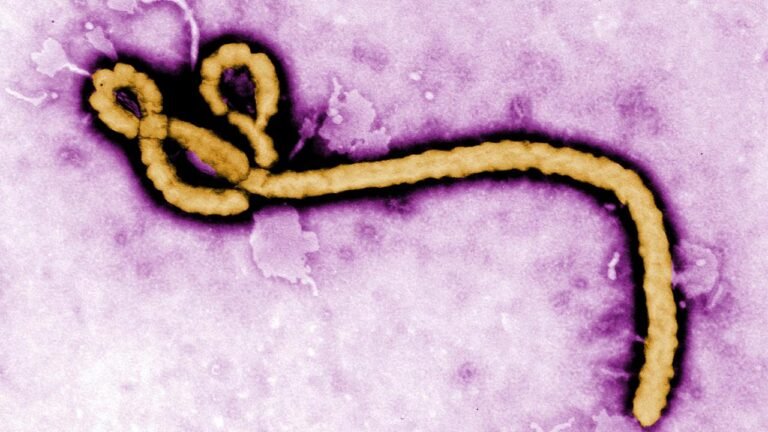 Ebola-Ausbruch in Demokratischer Republik Kongo bestätigt