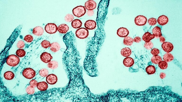 Colorado – Todesfall durch Hantavirus-Infektion