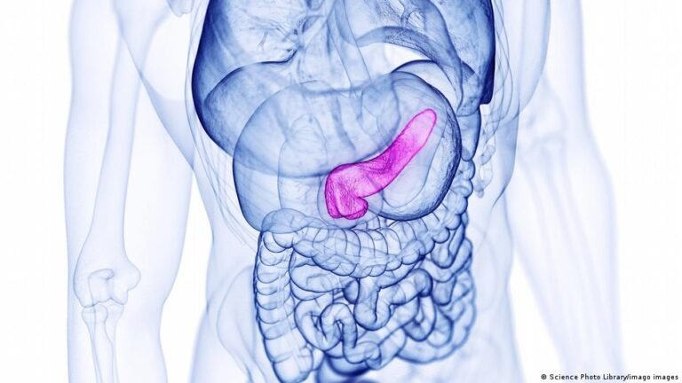 Bauchspeicheldrüsenkrebs: Kann eine mRNA-Impfung helfen?