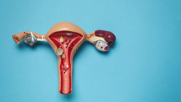 PMOS statt PCOS: Neuer Name für komplexe Hormon- und Stoffwechselstörung – Gesundheit